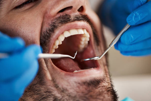 Best Weekend Emergency Dentist in Royalton, IL